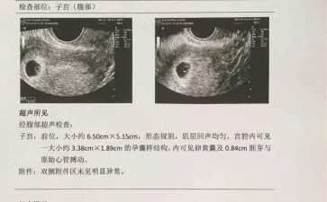 国内做供卵试管婴儿的公司,找个女人帮忙生孩子要多少钱？附费用一览！