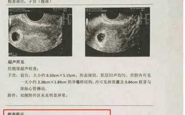 国内咨询代怀公司,赤峰试管医院哪家好赤峰试管婴儿医院排名
